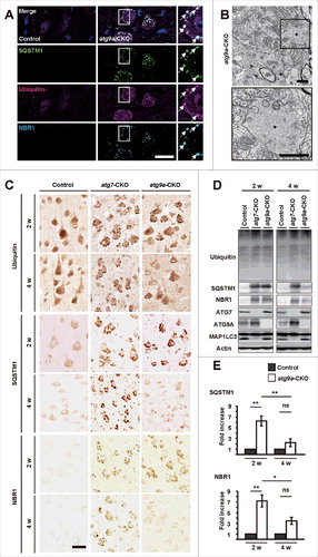 Figure 2. Accumulation of ubiquitin, SQSTM1 and NBR1 in atg9a-CKO mouse brains. (A) Immunofluorescence for SQSTM1, ubiquitin and NBR1 in neurons of DCN in atg9a-CKO mice at P15. White arrows indicate colocalization of positive signals for these proteins. Scale bars: 20 μm. (B) Electron micrographs of a DCN neuron in an atg9a-CKO mouse brain at P15. The square in the upper panel is enlarged in the lower panel. Asterisks in both figures indicate an ubiquitin aggregate that is encircled by ER. Scale bars: 1 μm. (C) Immunostaining of ubiquitin, SQSTM1 and NBR1 in the cerebrum cortexes of floxed control, atg7-CKO and atg9a-CKO mice at 2 and 4 wk of age. Scale bar: 20 µm. (D) Western blot analyses of ubiquitin, SQSTM1, NBR1, ATG7, ATG9A, and MAP1LC3A/B in brain lysates from floxed control, atg7-CKO and atg9a-CKO mice at 2 and 4 wk of age. Immunostaining for actin is used for an internal control. (E) Quantification of each protein band of SQSTM1 and NBR1. Results are expressed as mean ± SEM. * P < 0.05, ** P < 0.01, ns, not significant, n = 3 for each. Statistical analyses were performed using the Student t test.