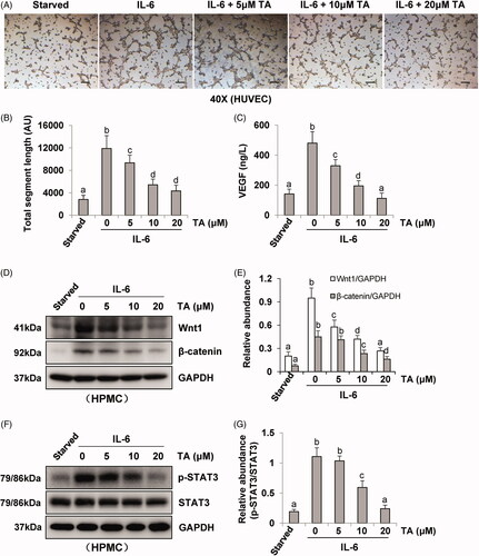 Figure 4. Blockade of HDAC6 with TA treatment prevents vasoformation in human umbilical vein endothelial cell. (A) Photomicrographs show capillary networks of tubes formed by HUVEC. (B) Quantitative analysis of total segment length. (C) VEGF ELISA kit was used to detect the levels of VEGF in cell culture media of HPMCs with different concentrations of TA. (D, F) Serum-starved HPMCs were pretreated with various concentrations of TA (51,020 μM) and then exposed to IL-6 (100 ng/ml) for 48 h. Cell lysates were subjected to immunoblot analysis with specific antibodies against Wnt1, β-catenin, p-STAT3, STAT3, and GAPDH. (E) Expression levels of Wnt1 and β-catenin were quantified by densitometry and normalized with GAPDH. (G) Expression level of p-STAT3 was quantified by densitometry and normalized with STAT3. Data are represented as the mean ± SEM. Means with different superscript letters are significantly different from one another (p < 0.05). All scale bars = 200 μm.