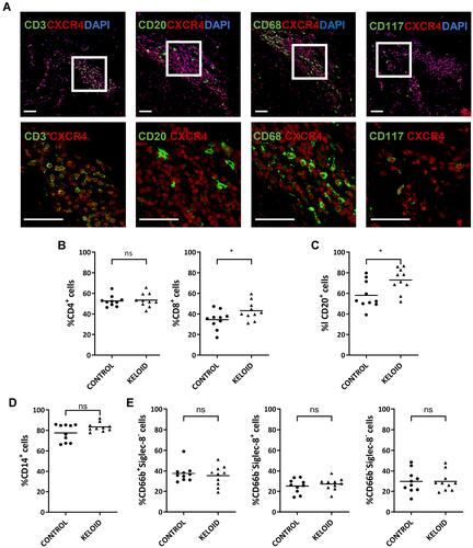 Figure 6 Expression of CXCR4 on circulating immune cells and keloid-resident inflammatory cells. (A) Immunofluorescence analysis of CXCR4 expression in different keloid-resident inflammatory cells (CD3+ T cells, CD20+ B cells, CD68+ macrophages and CD117+ mast cells) (n=12). Bars=50μm. (B–E) Flow cytometry analyses of CXCR4 expression in cycling CD4+ and CD8+ T lymphocytes (B), CD20+ B lymphocytes (C), CD14+ monocytes (D), and granulocytes, including CD66b+Siglec-8- neutrophils, CD66b−Siglec-8+ basophils, and CD66b−Siglect-8− eosinophils (E). Peripheral blood samples were collected from healthy subjects (Control) (n=10) and keloid patients (Keloid) (n=10); ns= P>0.05, *P < 0.05.