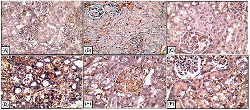 Figure 4. Representative photomicrographs of caspase-3 expression determined by immunohistochemistry. Notes: [A, B and C] There are 26, 23, and 21% of caspase-3 expressions in the cortical regions of kidney of control rats and in GSPE- or FO-treated rats, respectively. [D] Cisplatin administration increased strongly caspase-3 expression about 70% in inner cortical and outer medullary areas especially in the proximal convoluted tubules, whereas in the glomerular structure there was less caspase-3 expression. [E, F] There was inhibition of caspase-3 expression as evidenced by weak immunostaining about 45 and 49% in the distal tubules in the cortical regions of rat kidneys treated GSPE or FO, respectively.