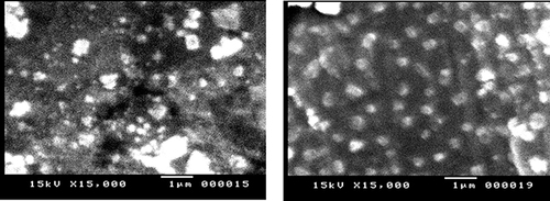 Figure 9 Representation showing SEM micrographs of curcumin-loaded transferosomes ((A), × 15,000) and curcumin transferosomes loaded in-situ gel ((B), × 15,000).