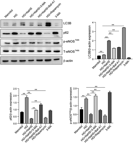 Figure 5. Effects of H2S on the eNOSThr495 signaling pathway in EPCs under HG conditions. Western blot was performed to detect the protein levels of LC3B, p62 and p-eNOSThr495 in EPCs between the 7 groups (Mannitol, HG, HG+NaHS, HG+NaHS+3-MA, HG+NaHS+Baf-A1, HG+Rapamycin and 3-MA alone). Quantification of protein expression in EPCs is shown. All experiments were repeated 3 times, and the numerical results were expressed as mean ± SD. One-way ANOVA was used to compare the differences among the 7 groups, and significant differences between treatment groups were indicated as **P < 0.01.