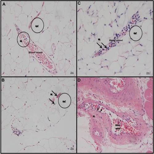 Figure 5 Representative slides from adipose tissue and muscle for animals receiving IP stool suspension.Notes: Hematoxylin and eosin staining (H&E) of c57Bl/6 mouse adipose tissue and muscle at 6 hours post- IP inoculation of stool (5 µl/g body weight). (A) epididymal adipose tissue. Embedded between ApCs are veins that exhibit several neutrophils in the lumen. (B) Peri-renal fat with focal serosal neutrophil infiltration with mixed bacteria (peritonitis) and veins containing neutrophils in the lumen. (C) Epididymal adipose tissue. Vein packed with NLs. H&E stain. (D) Muscle gastrocnemius. Larger artery with several neutrophils in the lumen (scale bar =20 µm, A–D). Representative adipocytes ApC are circled “Apc” in A, B, and C. A circle labeled “NL” marks a representative group of neutrophils in A and individual rolling neutrophils are arrowed “NL” in D.Abbreviations: IP, intraperitoneal; LPS, lipopolysaccharide; ApCs, adipocytes; NLs, neutrophils.