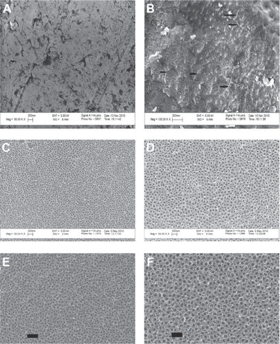 Figure 1 Scanning electron microscopy images. (A) Unanodized Ti sample showing a nearly smooth surface at the nanometer level. (B) Ti sample anodized in 1% HF for 1 minute at 10 V showing a nanotextured non-nanotubular surface; the black arrows show the ridge-like nanotextures interspersed between the tiny holes. (C) Ti sample anodized with 1% HF for 10 minutes at 15 V showing nanotubes of 40–50 nm diameters. (D) Ti sample anodized with 1% HF for 10 minutes at 20 V showing nanotubes of 60–70 nm diameters. (E) Enlarged portion of nanotubes of 40–50 nm diameter. (F) Enlarged portion shows nanotubes 60–70 nm diameter (scale bar = 200 nm).Abbreviations: HF, hydrofluoric acid; Ti, titanium.