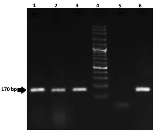 Figure 5. Agarose gel electrophoresis of PCR products from maize samples for analysis of MON810 (170 bp) line. Lanes 1–3: positive samples; Lane 4: 100 bp DNA ladder; Lane 5: negative control; Lane 6: positive control