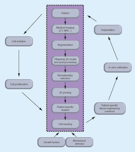 Figure 1. Representation of the envisioned patient-specific intervertebral disc tissue engineering strategy with the highlighted role of the present study in the center.The data obtained from medical imaging of the patient's intervertebral disc (IVD) are segmented and processed into a 3D model to be used in 3D printing the selected biomaterial(s) of a patient-specific IVD implant. Different types of biomaterials can be used for reproducing the annulus fibrosus and nucleus pulposus. The autologous cells are isolated from the patient, proliferated in vitro and introduced into patient-specific scaffold in the presence of growth factors and mechanical stimulus. The tissue engineered patient-specific construct cultured in vitro can be then implanted into the patient.AF: Annulus fibrosus; IVD: Intervertebral disc; NP: Nucleus pulposus.