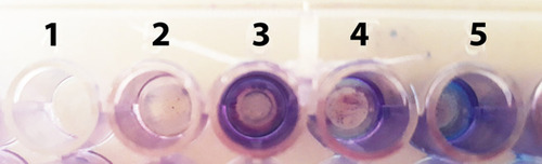 Figure 6 Antibiofilm effect of different groups against MDR V. cholerae strains, including: 1) PBS; 2) MSCs CM + V. cholerae; 3) V. cholerae; 4) MSCs CM-CS NPs + V. cholerae; 5) V. cholerae + CS NP.