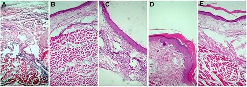 Figure 7 Histopathological studies of rats’ paws using H&E stains.