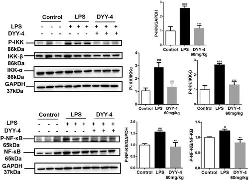 Figure 6. DYY-4 inhibited IKK/NF-κB inflammasome pathway in ALI mice. LPS (2 mg/kg) was instilled intratracheally (i.t.) to induce lung injury, half an hour after LPS challenge, DYY-4 was given to each administration group, and the second administration was carried out 1 h later. Twenty-four h after LPS challenge, western blot analysis was performed to detect the protein levels of IKKα, IKK-β, p-IKKα/β, NF-κB p-p65 and NF-κB p65 in lung tissue. Data expressed as means ± S.D. (n = 3); #p < 0.05, ##p < 0.01 and ###p < 0.001 compared with control, **p < 0.01 and ***p < 0.001 compared with vehicle treated ALI model group.