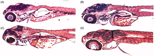 Figure 4. Histochemical analyses of zebrafish larvae. Representative sagittal sections of an untreated zebrafish larva (A) or larva treated with 500 μM of compound 3 (B), 4 (C) or 10 (D). The images presented here are selected from three independent groups of experiments.