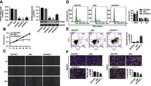 Figure 1 Knockdown of HOXB7 inhibited the cancer progression of SGC7901 cells.Notes: SGC7900 cells were transfected with siRNA-NC (siNC) and siRNA-HOXB7 (siHOXB7-1, siHOXB7-2 and siHOXB7-3). (A) After 48 hours, mRNA and protein levels of HOXB7 were assessed by RT-PCR and Western blot, respectively. (B) After transfection at 0, 12, 24, 48, and 72 hours, cell proliferation was measured using CCK8. (C) The wound-healing process was measured by wound-healing assay at 0, 24, and 48 hours. (D) Cell cycle and (E) cell apoptosis were assessed by annexin V–PI staining. (F) Cell migration and (G) invasion were assessed with a transwell chamber (five visual fields randomly selected). **P<0.01 versus siNC.