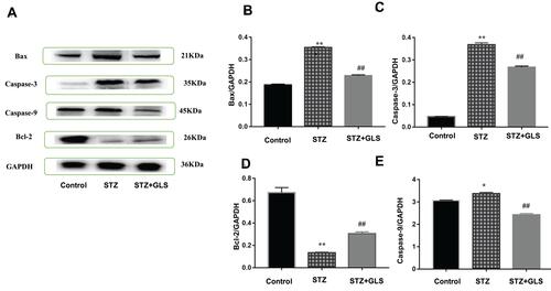 Figure 5 Effect of Ganoderma lucidum spore (GLS) on the protein expression of Bax (molecular weight, 21 kDa), caspase 3 (molecular weight, 35 kDa), and 9 (molecular weight, 45 kDa) and Bcl-2 in cardiac tissues according to Western blotting (A), and statistical analysis of their relative densities (B–E). Values represent the mean ± SE; n = 3 in each group. *, p <0.05 and **, p < 0.01 versus the control group and ##, p < 0.01 versus STZ group using Tukey’s test. Control: 5 mL/kg saline (p.o.); Diabetic: 50 mg/kg streptozotocin (i.p.) and 5 mL/kg saline (p.o.); STZ +GLS: 50 mg/kg streptozotocin (i.p.) and 300 mg/kg GLS (p.o.).