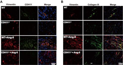Figure 7 Loss of CDH11 alleviated Ang-II-induced collagen-III synthesis in LA tissue. Both WT and CDH−/- mice were received continuous infusion of saline or Ang-II (1 μM) for 28 days, following by harvesting LA tissues for immunofluorescent staining. Double immunostaining of (A) Vimentin (red) and CDH11 (green) or (B) Vimentin (red) /Collagen-III (green) were carried out on LA tissues from WT or CDH11−/- mice in presence or absence of Ang-II treatment. Dapi stained for nuclei (blue).