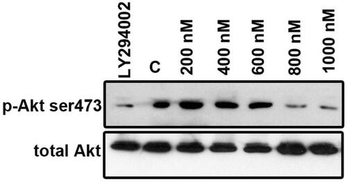 Figure 8. ZnS-NPs regulate Akt phosphorylation (Ser473) in MRPE cells. MRPE cells were pre-treated with various concentrations of ZnS-NPs and Akt phosphorylation inhibitor LY294002 (10 μM) and analysed by western blotting using phospho-specific Akt antibody. 0.5% FBS-availed cells were used as control. As a loading control, same samples were analysed using total Akt antibody. These experiments were performed thrice with similar results and significant differences from control group were observed.