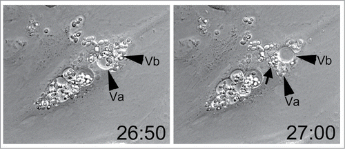 Figure 4. Live C. parapsilosis escaped from endothelial vesicles. After prolonged internalization, yeast cells were occasionally observed in fluid filled vesicles (arrowheads, Va and Vb). Ten minutes later, Va has collapsed, while Vb has enlarged. A cluster of newly expelled yeast cells is visible at the arrow. The time stamp is in hours and minutes and was initiated at the time of addition of live yeast cells to HUVEC. Data are also shown as Movie S2.