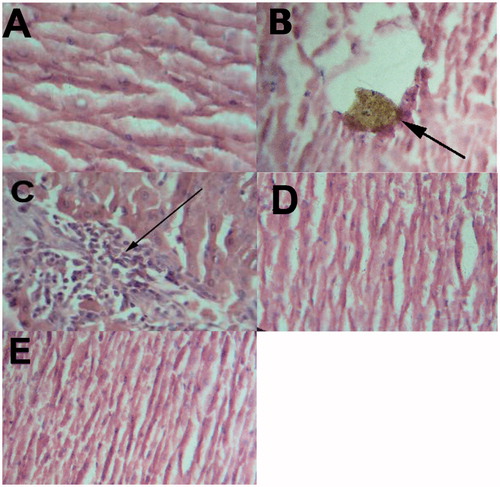 Figure 2. Photomicrography of rat liver sections in experimental groups. (A) Normal control (the first group); (B and C) lead-exposed rats without treatment (the second group); (D) lead-exposed rats supplemented with artichoke extract (group three); (E) lead-exposed rats supplemented with vitamin C (group four) (H&E stain). Figure 2B Shows a macrophage-laden with yellowish brown pigment in rats without treatment. (C) Shows infiltrated mononuclear cells (arrow) in rats without treatment.