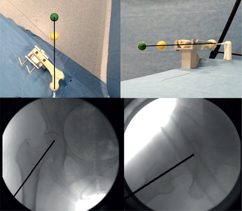 Figure 1. Control screen of the FluoroSim software running with the calibration femur. The software locates the colored markers and finds their center. It marks the position of the guide-wire on the camera image and, using the ATM, overlays this onto the pre-loaded radiograph. Both AP and CTL images are produced.