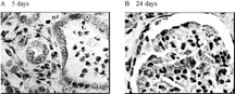 Figure 7 Effects of SFHb transfusion on renal function for 30% bleeding rats. (A) Endothelial cell necrosis and neutrophile granulocyte hyperplasia in nephric tubules. (B) Red blood cells and leucocyte appeared in glomerulus sacculus.