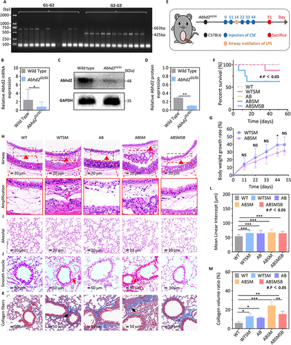 Figure 4 Gene identification and pathological observation of respiratory tract in mice. (A) DNA agarose gel electrophoresis results of mice. Mice were identified with primer sets G1-G2 (663 bp fragment) and primer sets G2-G3 (425 bp fragment): –/+, homozygous mutant mice (Abhd2Gt/Gt); + /+, heterozygous mice; + / –, wild type mice. (B) Relative expression of Abhd2 mRNA in lung tissue. (C and D) Expression of Abhd2 protein in lung tissue detected by Western blot. (E) Flow Chart of Mouse Model Construction. (F) Survival curve of different groups. (G) Body weight growth trend of COPD mice. (H) Changes of airway epithelium, glands, and inflammatory cells (HE×400). Red triangles pointed to inflammatory cells. (I) Representative pictures of alveolar spaces and alveolar walls (HE×400). (J) Observation of smooth muscle thickness in lung (HE×200). Red arrows were thickened smooth muscle. (K) Collagen fibers stained with Masson (Magnification, ×200). Black arrows pointed to collagen fibers stained blue. (L) Comparison of mean lining intervals (MLI) in mouse lung tissue. (M) Comparison of collagen volume ratio calculation among groups. Multiple group comparisons were performed by ANOVA analysis and post hoc multiple comparisons were performed by Bonferroni method. *P < 0.05; **P < 0.01; ***P < 0.001; # P < 0.05, comparison of overall means among five groups (ANOVA); NS, not significant.