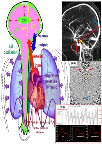 Figure 1. Cranio spinal dynamics investigated by MRI.