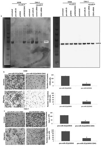 Figure 4. CDH1 plays a critical role in miR-25-mediated invasion and migration in NSCLC cells. (a) H358 cells were co-transfected with pre-miR or pre-miR-25 and pCMV6 or pCMV6-CDH1 for 24 h, Calu-1 cells were co-transfected with anti-miR or anti-miR-25 and control siRNA or CDH1 siRNA for 24 h, expression of CDH1 was detected by Western blot assay. (b) H358 cells were co-transfected with pre-miR or pre-miR-25 and pCMV6 or pCMV6-CDH1 for 24 h, cell invasion and cell migration were detected. (c) Calu-1 cells were co-transfected with anti-miR or anti-miR-25 and control siRNA or CDH1 siRNA for 24 h, cell invasion and cell migration were detected. Cell lysates were prepared for Western blotting using antibody against CDH1 after transfection. *p < 0.05.