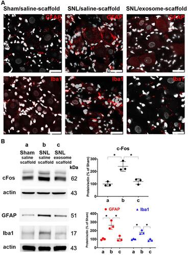 Figure 5 Implantation of stem cell exosome-scaffold on ligated nerves attenuates L5/6 spinal nerve ligation (SNL)-induced neuron and glial activation in ipsilateral L5/6 dorsal root ganglion (DRG). (A) Representative immunofluorescent image showing SNL-induced GFAP (satellite glial cell marker) and Iba1 (macrophage marker) over-expression was attenuated by exosome-scaffold treatment on day 7 after surgery. The white spots are DAPI nuclear staining. Scale bar: 25 μm. (B) Left: representative Western blots of c-Fos (postsurgery day 1), GFAP and Iba1 (postsurgery day 7) of ipsilateral L5/6 DRG, actin used as internal control. Right: summarized graph depicting protein levels presented as raw data points and Mean ± SD, taking Sham/saline-scaffold group as 100% (*P<0.05, Kruskal–Wallis test followed by Dunn’s multiple pairwise comparisons test, n=3 in each group).