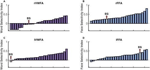 Figure 4. Selectivity indices for EG and controls. Histogram was used to show the visual word selectivity (A, C) and face selectivity (B, D) indices both controls and EG. Each bar represents one participant and participants are ordered by their selectivity indices from lowest to highest.