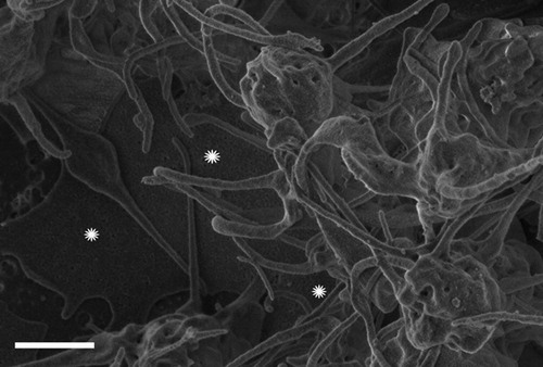 Figure 5. Scanning electron microscopy micrograph of a plasma sample with 10 μM ferric chloride. White stars indicate dense amorphous deposits intermingled with fibrin-like strands.