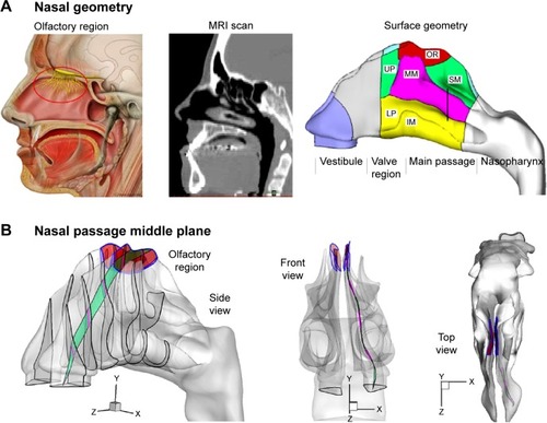 Figure 1 Human nose model and the olfactory region.Notes: The red circle highlights where the olfactory region is located. (A). For optimal olfactory drug delivery, particles should travel along the middle plane (B) of the nasal passage, which exhibits complex spatial features.Abbreviations: IM, inferior meatus; LP, lower passage; MM, middle meatus; MRI, magnetic resonance imaging; OR, olfactory region; SM, superior meatus; UP, upper passage.