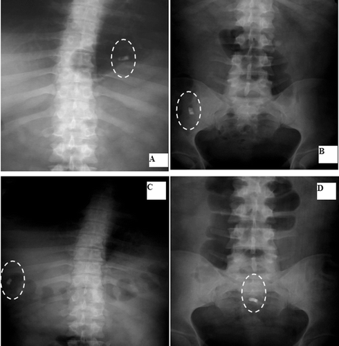 Figure 8.  Localization of F14 throughout the GIT: A: Stomach after 20 min. B: Ileum after 3 hrs. C: Transverse colon after 5 hrs. D: Rectum after 8 hrs.