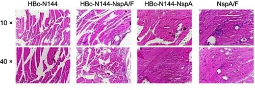 Figure 9 Pathology analysis. Tissues were dissected from the injection sites of mice in the different groups and examined by electron microscopy with 10× and 40× lenses.Abbreviations: HBc-N144, N terminal 144 amino acids of hepatitis B core protein; HBc-N144-NspA, Neisserial surface protein A fused with the N terminal 144 amino acids of hepatitis B core protein; HBc-N144-NspA/F, the HBc-N144-NspA fusion protein plus Freund’s adjuvant; NspA/F, Neisserial surface protein A plus Freund’s adjuvant.