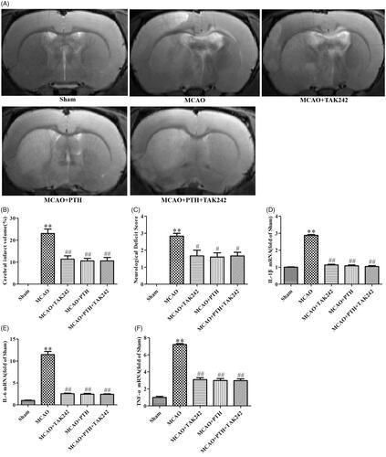 Figure 8. TAK-242 did not obviously enhance the anti-inflammatory effect of PTH on cerebral ischaemic injury. (A) Representative T2-weighted images of brain sections in different groups (n = 6). (B) Quantitative analysis of infarct volume in different groups (n = 6). (C) Quantitative analysis of neurological deficits in different groups (n = 6). (D-F) Quantitative analysis of IL-1β (D), IL-6 (E) and TNF-α (F) mRNA levels in different groups (n = 3). Data are presented as mean ± SEM. **p < 0.01 vs. Sham; #p < 0.05, ##p < 0.01 vs. MCAO.