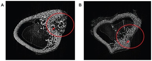 Figure 8 Synchrotron radiation-based microcomputed tomography of a three-dimensional reconstruction of cross-section images of mesoporous bioactive glass and polyamide composite scaffolds implanted into bone defects of rabbit femora for (A) 4 weeks and (B) 12 weeks.Note: Circle and arrow show the bone defect area site.