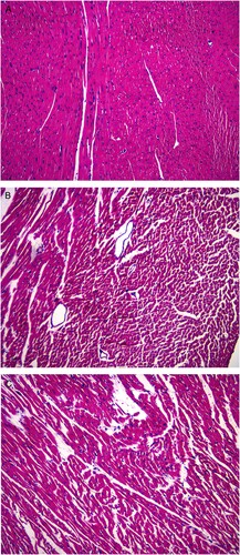 Figure 3. Changes in myocardial histology in the three groups of rats HE staining (×200) showing the pathomorphology of the myocardial tissues in the three groups of rats. (A) Normal histology in the myocardial tissues of the rats in the normal control group. (B) Cardiomyocyte necrosis was observed under the intima of the left ventricle and throughout the myocardium in the DCM + control group. (C) Tissues of rats in the DCM + treatment group exhibited less severe necrotic fibrosis, a small amount of fibrosis adjacent to some cardiomyocytes, and better cardiomyocyte arrangement.