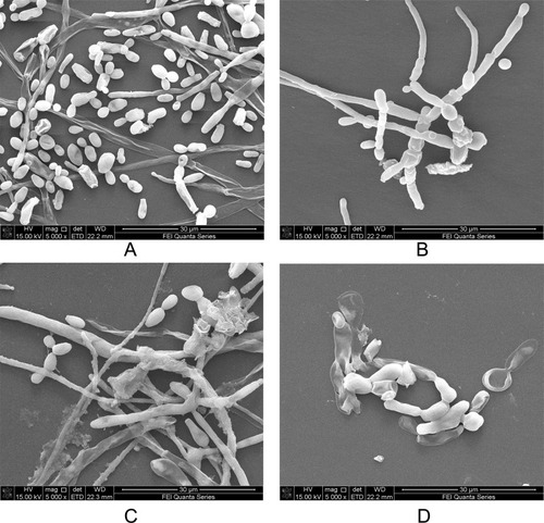 Figure 6 The scanning electron micrographs of PAB in combination with FLC against biofilm (5000x). (A) The control (without FLC and PAB); (B) 16 µg/mL FLC; (C) 4 µg/mL PAB; (D) 4µg/mL PAB + 16µg/mL FLC.