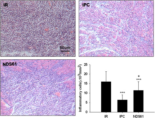 Figure 4. Treg cell depletion inhibits anti-inflammatory effect of IPC. On day-1, before 30-min myocardial ischemia, preconditioned rats were injected with NDS61 or control IgG. At the end of 48-h reperfusion, some heart sections were stained with hematoxylin and eosin to assess total inflammatory cell infiltration in the different treatment groups. Data are presented as the mean ± S.D.; ***p < 0.001 compared to Sham/IR-IgG; †p < 0.05 compared to IPC/IR-IgG. IPC, ischemic preconditioning; IR, ischemia-reperfusion (original magnification 200×).