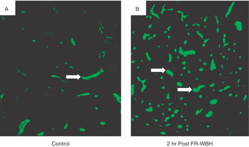 Figure 1. Fluorescence photomicrographs of CT26 tumor sections from mice maintained under normothermic conditions or given pre-treatment with FR-WBH comparing the density of DiOC7 (3)-labeled blood vessels. DiOC7(3) was injected at various time points post sham (A) or FR-WBH (B) treatment. Shown here is representative data from the 2 hour post treatment time point demonstrating an increase in the number of perfused vessels in tumors removed from mice given pre-treatment with FR-WBH. The animals were sacrificed within 1 minute after the injection and tumors were quickly excised and frozen in liquid nitrogen. Arrows show the presence of blood vessels containing dye. These data are representative of 3 separate experiments, with 4 mice per group in each experiment.