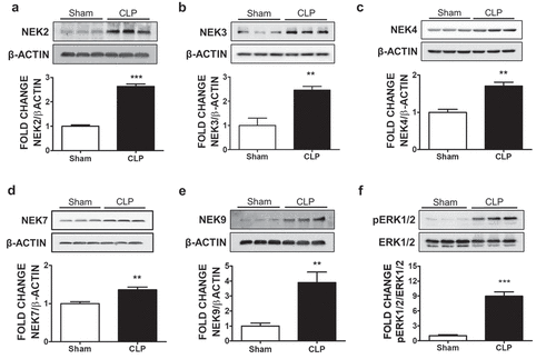 Figure 1. Effects of CLP-induced sepsis on NEK kinases expression in mice lungs. C57BL/6 mice were subjected to either sham surgery or CLP. 24 H after the surgery, mice were sacrificed and lung tissues were collected for the western blot analysis of NEK2 and β-actin (a), NEK3 and β-actin (b), NEK4 and β-actin (c), NEK7 and β-actin (d), NEK9 and β-actin (e), phospho-ERK1/2 (pERK1/2) and ERK1/2 (f). The signal intensity of the bands was analyzed by densitometry. Protein levels were normalized to β-actin unless indicated otherwise in the graph of densitometry. **P <.01, ***P <.001 vs sham, N = 3. Means ± SEM