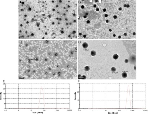 Figure 1 Transmission electron microscopy images of poly-ε-caprolactone nanoparticles (PCL NPs). Small (A), large (B), Polylactic acid NP 50 nm (C) and 500 nm (D) NPs. Dynamic light-scattering data of small PCL NPs (E) and large PCL NPs (F).