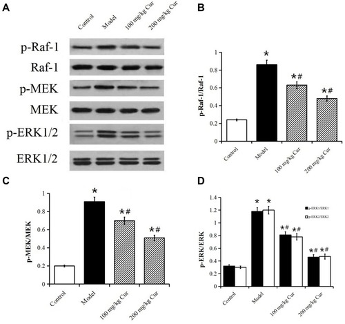 Figure 6 Effect of Cur on phosphorylation level of Raf-1, MEK and ERK1/2 protein in rabbit carotid artery tissue. (A) Western blot analysis the p-Raf-1/Raf-1, p-ERK/ERK, p-MEK/MEK in rabbit carotid tissue at 4 weeks after CEA. (B–D) The levels of phosphorylation proteins. The data are represented as mean±s.d.*P<0.05, compared with the control group; #P<0.05, compared with the model group.