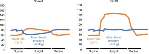 Figure 2 Supine and upright heart rate and blood pressure.
