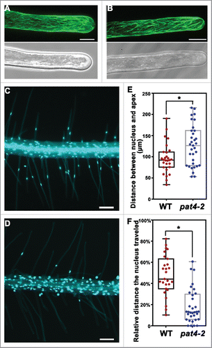 Figure 1. Distribution of microtubule and nuclei in wild-type and pat4–2 root hairs. (A-B) CLSM projections of a growing root hair from Pro35S: GFP-MBD (A) or Pro35S: GFP-MBD; pat4–2 (B). (C-D) A representative primary root of wild-type (C) or pat4–2 (D) seedlings at 4 d after germination (DAG) stained with DAPI. (E) Distance between nucleus and the apex. (F) Relative distance the nucleus traveled (distance between the nucleus and the root hair base fractionated with root hair length). Results shown in (E) and (F) are means ± standard deviation (n = 30). Asterisks indicate significant difference (t-test, P < 0.05). Bars = 10 μm for (A-B); 100 μm for (C-D).