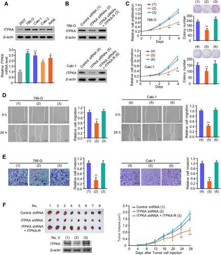 Figure 2 ITPKA promotes RCC proliferation, migration and invasion both in vitro and in vivo. (A) Total proteins extracted from the indicated RCC cell lines were analyzed by Western-blot with anti-ITPKA. β-actin was used as a loading control. (B) 786-O and Caki-1 cells were transfected with Control siRNA or ITPKA siRNAs or ITPKA siRNAs plus ITPKA. The immunoblot shows ITPKA expression. (C) Cell proliferation and colony formation, wound healing (D) and transwell (E) assays of 786-O and Caki-1 cells transfected as in (B). (1), (2), (3) represent 786-O cells transfected with Control siRNA, ITPKA siRNAs, ITPKA siRNAs plus ITPKA, respectively. (4), (5), (6) represent Caki-1 cells transfected with Control siRNA, ITPKA siRNAs, ITPKA siRNAs plus ITPKA, respectively (B–D). Illustrative images show colonies in plates, cell migration and invasion. Histograms show colony number, comparative cell migration and invasion. All values displayed are mean ± SD and have been duplicated 3 times with similar results (A–D). *p < 0.05 and **p < 0.01 versus corresponding Control siRNA. (F) 786-O cells stably infected with lentivirus carrying the indicated constructs were injected into nude mice as indicated. After 28 days, mice were sacrificed to harvest tumors. At the indicated times, the tumors were measured (mean ± SD, n = 8), and the growth curve was plotted. **p < 0.01 vs. Control shRNA group.