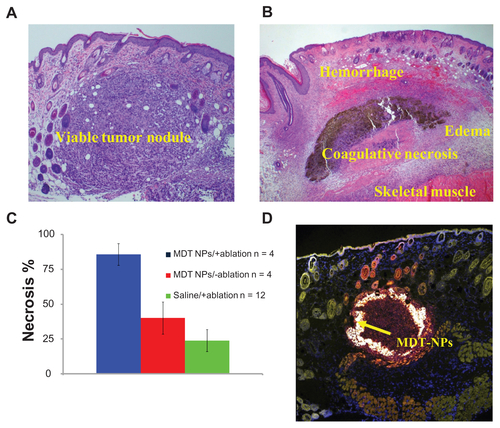 Figure S6. Histological analysis of tumor sections: (A) saline/+ablation and (B) multi-dye theranostic silica nanoparticles (MDT-NPs)/+ablation stained with hematoxylin and eosin demonstrate areas of viability and necrosis, respectively. (C) Histogram shows significantly more necrosis in tumors irradiated with laser in presence of MDT-NPs, as determined by a board-certified pathologist (JAK). (D) Confocal microscope image (10× magnification) of a representative tissue section (stained using CellMaskTM Orange) containing MDT-NPs (shown by arrow).