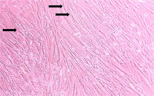 Figure 1 Morphology of fibroblast cells.