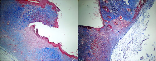 Figure 3. Significant fibrosis (left) was observed in the S-14 group, while mild fibrosis (right) was noted in the EE-14 group. (Masson Trichrome; ×40).