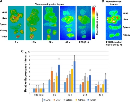 Figure 8 In vivo tracking of fluorescently labeled MSCs-derived exosomes in harvested tissues from tumor-bearing or control mice.Notes: (A) Exosomes labeled with PKH67 were intravenously injected (30 µg of purified exosomes from MSCs) into mice bearing TUBO tumors. Lung, liver, spleen, kidney, and tumor tissues were harvested after 3, 12, 24, and 48 hours postinjection for ex vivo imaging. The fluorescent signal of PKH67-labeled MSCs-Exo was detected using IVIS. (B) The lung, liver, spleen, and kidney were also harvested from normal mice injected with 30 µg of labeled MSCs-Exo as control immediately after injection and fluorescent signal was acquired using IVIS. (C) The relative mean fluorescence intensity in the lung, liver, spleen, kidneys, and tumor tissues as a function of time after intravenous injection of fluorescently labeled MSCs-Exo. The fluorescence intensity in tumor tissues dissected from the mice injected with fluorescent exosomes was significantly higher compared to the fluorescence intensity in tumor tissue dissected from the control mouse (*P<0.05).Abbreviations: IVIS, in vivo imaging system; MSCs-Exo, mesenchymal stem cells-derived exosomes.