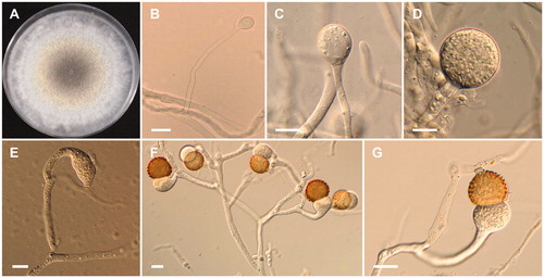 Figure 5. Morphology of Mucor heterogamus CNUFC-YR7. (A) Colony on potato dextrose agar; (B–D) Branched sporangiophores and sporangia; (E–G) Zygospores. Scale bars: B–G = 20 μm.