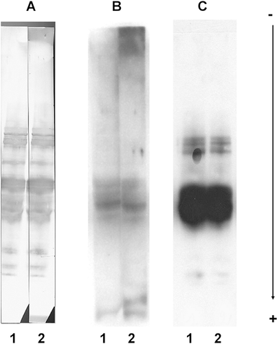 Figure 1.  Common side reactions due to secondary antibodies. Direct immuno-probing of blotted total wheat proteins, with human sera (lane 1) or without human sera (for control, lane 2) along with different secondary antibody preparations and quenching reagents. Reactions were detected with, respectively: (A) Bio-Rad Opti-4CN detection kit (rabbit anti-human IgE-HRP at 1/1000, blocking reagent from Roche Diagnostics, washings in PBST); (B) Aurora detection kit (goat anti-human IgE-AP at 1/10,000, blocking reagent from the kit, washings in blocking reagent); (C) Pierce SuperSignal West Dura Extended Duration® 8 substrate (rabbit anti-human IgE-HRP at 1/10,000, blocking reagent from the Aurora detection kit, washings in PBST). B and C are chemiluminescence methods, whereas A is a colorimetric method.