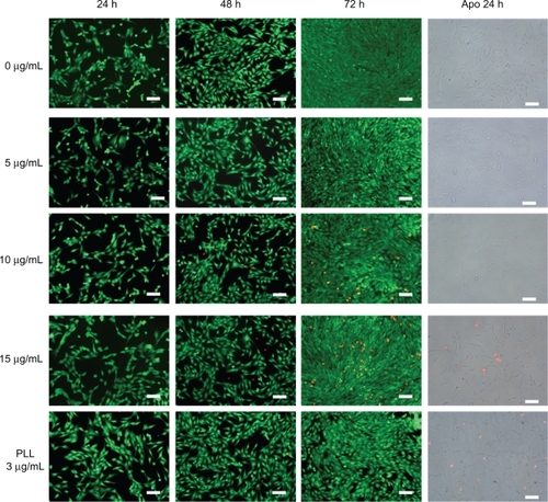 Figure 5 LIVE/DEAD® viability/cytotoxicity assay and early apoptotic detection (annexin V-FITC/PI assay) performed for different incubation times and concentrations.Note: Scale bar: 100 μm.